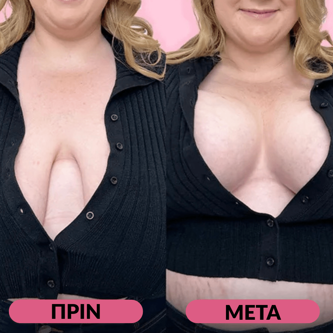 Boob Lifter